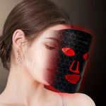 IPL Photon Skin Rejuvenation Device — At-Home Beauty Treatment