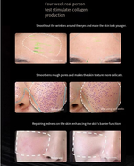 IPL Photon Skin Rejuvenation Beauty Mask Device
